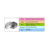 Composite bottom paragraph 03 stainless steel pot ears picture   25*9